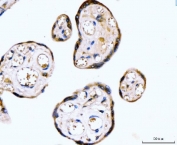 IHC staining of FFPE human placental tissue with RYR2 antibody. HIER: boil tissue sections in pH8 EDTA for 20 min and allow to cool before testing.