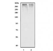 Western blot testing of 1) rat heart and 2) mouse heart tissue lysate with RYR2 antibody. Predicted molecular weight ~565 kDa.