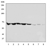 Western blot testing of 1) human ThP-1, 2) human Jurkat, 3) human Raji, 4) human HL60, 5) rat stomach, 6) rat testis, 7) mouse stomach and 8) rat testis tissue lysate with SREBP2 antibody. Predicted molecular weight ~124 kDa but may be observed at higher molecular weights due to glycosylation. The active form of this protein can be observed at 50-68 kDa.