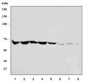Western blot testing of 1) human ThP-1, 2) human Jurkat, 3) human Raji, 4) human HL60, 5) rat stomach, 6) rat testis, 7) mouse stomach and 8) rat testis tissue lysate with SREBP2 antibody. Predicted molecular weight ~124 kDa but may be observed at higher molecular weights due to glycosylation. The active form of this protein can be observed at 50-68 kDa.