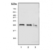 Western blot testing of 1) human HeLa, 2) rat brain and 3) mouse brain tissue lysate with Sorcin antibody. Predicted molecular weight ~22 kDa, routinely observed at 22-29 kDa.