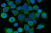 Immunofluorescent staining of FFPE human SiHa cells with Sorcin antibody (green) and DAPI nuclear stain (blue). HIER: steam section in pH6 citrate buffer for 20 min.