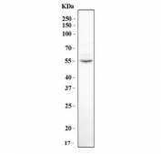 Western blot testing of human Jurkat cell lysate with Telomeric repeat-binding factor 1 antibody. Predicted molecular weight: 50-65 kDa depending on level of acetylation.