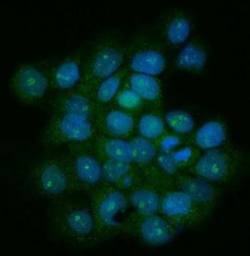 Immunofluorescent staining of FFPE human A431 cells with Telomeric repeat-binding factor 1 antibody (green) and DAPI nuclear stain (blue). HIER: steam section in pH6 citrate buffer for 20 min.~