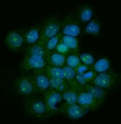 Immunofluorescent staining of FFPE human A431 cells with Telomeric repeat-binding factor 1 antibody (green) and DAPI nuclear stain (blue). HIER: steam section in pH6 citrate buffer for 20 min.