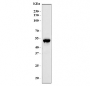 Western blot testing of human MCF7 cell lysate with AP2 gamma antibody. Predicted molecular weight ~49 kDa.