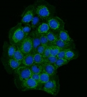 Immunofluorescent staining of FFPE human A431 cells with Zonula occludens protein 2 antibody (green) and DAPI nuclear stain (blue). HIER: steam section in pH6 citrate buffer for 20 min.