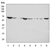 Western blot testing of 1) human HepG2, 2) human HCCT, 3) human HCCP, 4) human HeLa, 5) rat brain, 6) rat C6, 7) mouse brain and 8) mouse Neuro-2a cell lysate with TNFRSF1A antibody. Predicted molecular weight ~51 kDa.