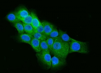 Immunofluorescent staining of FFPE human A431 cells with CIP4 antibody (green) and DAPI nuclear stain (blue). HIER: steam section in pH6 citrate buffer for 20 min.~