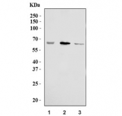 Western blot testing of human 1) A375, 2) A431 and 3) HaCaT cell lysate with TYR antibody. Predicted molecular weight: 60-84 kDa depending on level of glycosylation.