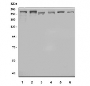 Western blot testing of 1) human HeLa, 2) human 293T, 3) human HepG2, 4) rat brain, 5) rat liver and 6 mouse brain tissue lysate with USP9X antibody. Predicted molecular weight ~290 kDa.