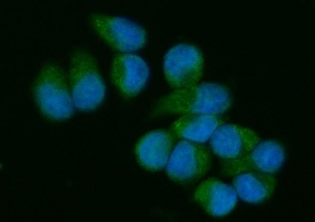 Immunofluorescent staining of FFPE human T-47 D cells with VAV3 antibody (green) and DAPI nuclear stain (blue). HIER: steam section in pH6 citrate buffer for 20 min.~