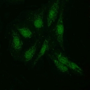 Immunofluorescent staining of FFPE human U-2 OS cells with KIAA1429 antibody.