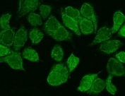 Immunofluorescent staining of FFPE human MCF7 cells with WNT8B antibody. HIER: steam section in pH6 citrate buffer for 20 min.