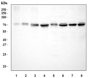 Western blot testing of human 1) U-87 MG, 2) A431, 3) A549, 4) U-251, 5) U-2 OS, 6) HeLa, 7) HaCat and 8) SiHa cell lysate with ADAM9 antibody. Expected molecular weight: 90-100 kDa (pro-ADAM9-L form) and 70-80 kDa (ADMA9-L form).