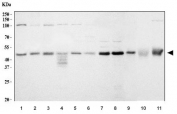 Western blot testing of 1) human HeLa, 2) human 293T, 3) human HepG2, 4) human Jurkat, 5) human RT4, 6) human MCF7, 7) human MOLT4, 8) human HEL, 9) rat brain, 10) rat liver and 11) rat RH35 cell lysate with ATG4B antibody. Expected molecular weight: 37-52 kDa (multiple isoforms).