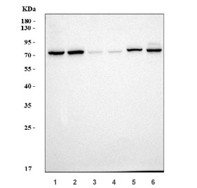 Western blot testing of 1) rat brain, 2) rat kidney, 3) rat thymus, 4) rat NRK, 5) mouse brain and 6) mouse kidney tissue lysate with ATP6V1A antibody. Predicted molecular weight ~68 kDa.