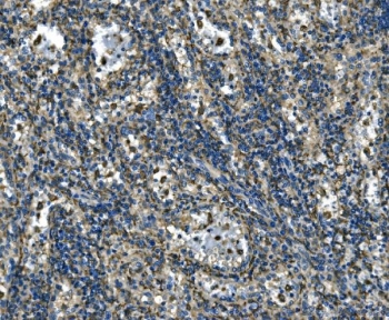 IHC staining of FFPE human splenic rupture tissue with ATP6V1A antibody. HIER: boil tissue sections in pH8 EDTA for 20 min and allow to cool before testing.