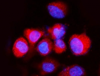 Immunofluorescent staining of FFPE human A549 cells with ATP6V1A antibody (red) and DAPI nuclear stain (blue). HIER: steam section in pH6 citrate buffer for 20 min.