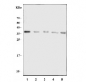 Western blot testing of 1) rat spleen, 2) rat thymus, 3) mouse spleen, 4) mouse thymus and 5) mouse RAW264.7 cell lysate with Azurocidin antibody. Expected molecular weight: 27-37 kDa.