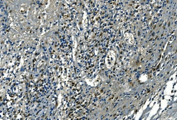 IHC staining of FFPE human appendicitis tissue with Azurocidin antibody. HIER: boil tissue sections in pH8 EDTA for 20 min and allow to cool before testing.
