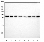 Western blot testing of 1) human HCCT, 2) human HCCP, 3) human MCF7, 4) human HeLa, 5) rat liver, 6) rat L6, 7) mouse liver and 8) mouse C2C12 cell lysate with BEX3 antibody. Predicted molecular weight ~13 kDa (monomer) but commonly observed at ~24 kDa. The dimer may be observed at 40-50 kDa.