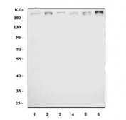 Western blot testing of human 1) 293T, 2) Jurkat, 3) K562, 4) MCF7, 5) PC-3 and 6) HL60 cell lysate with Bromodomain-containing protein 4 antibody. Predicted molecular weight ~156 kDa (long form, can be observed at 200+ kDa) and ~81 kDa (short form).