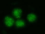 Immunofluorescent staining of FFPE human PC-3 cells with Bromodomain-containing protein 4 antibody.