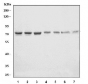 Western blot testing of 1) rat liver, 2) rat liver, 3) rat RH35, 4) mouse liver, 5) mouse liver, 6) mouse RAW264.7 and 8) mouse ANA-1 cell lysate with C5B antibody. Predicted molecular weight ~189 kDa (C5), 75-80 kDa (beta chain).