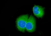 Immunofluorescent staining of FFPE human SiHa cells with Caspase-3 antibody (green) and DAPI nuclear stain (blue). HIER: steam section in pH6 citrate buffer for 20 min.