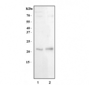 Western blot testing of human 1) HCCT and 2) RT4 cell lysate with CD9 antibody. Predicted molecular weight is 23-27 kDa.