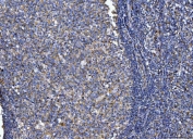IHC staining of FFPE human tonsil tissue with CD14 antibody. HIER: boil tissue sections in pH8 EDTA for 20 min and allow to cool before testing.