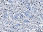IHC staining of FFPE human spleen tissue with CD14 antibody. HIER: boil tissue sections in pH8 EDTA for 20 min and allow to cool before testing.