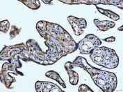 IHC staining of FFPE human placental tissue with CD14 antibody. HIER: boil tissue sections in pH8 EDTA for 20 min and allow to cool before testing.