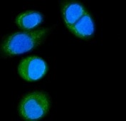 Immunofluorescent staining of FFPE human SiHa cells with CD14 antibody (green) and DAPI nuclear stain (blue). HIER: steam section in pH6 citrate buffer for 20 min.
