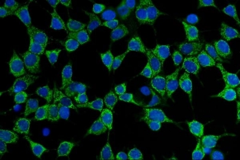 Immunofluorescent staining of FFPE human MCF7 cells with CD86 antibody (green) and DAPI nuclear stain (blue). HIER: steam section in pH6 citrate buffer for 20 min.