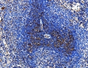 IHC staining of FFPE rat spleen tissue with Cd86 antibody. HIER: boil tissue sections in pH8 EDTA for 20 min and allow to cool before testing.
