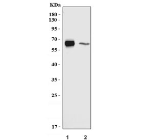 Western blot testing of 1) rat lung and 2) mouse lung tissue lysate with Cd86 antibody. Predicted molecular weight ~38 kDa (unmodified), 45-70 kDa (glycosylated).