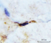 IHC staining of FFPE mouse skeletal muscle tissue with M Cadherin antibody. HIER: boil tissue sections in pH8 EDTA for 20 min and allow to cool before testing.