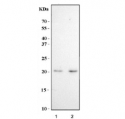 Western blot testing of human 1) MOLT4 and 2) HEL cell lysate with CDKN2D antibody. Predicted molecular weight ~18 kDa.