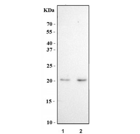 Western blot testing of human 1) MOLT4 and 2) HEL cell lysate with CD
