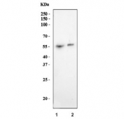 Western blot testing of 1) rat stomach and 2) mouse stomach tissue lysate with AMCase antibody. Predicted molecular weight ~52 kDa.