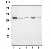 Western blot testing of 1) human K562, 2) human HepG2, 3) rat spleen, 4) rat PC-12 and 5) mouse spleen tissue lysate with CIITA antibody. Predicted molecular weight ~123 kDa.