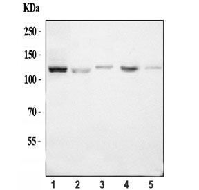 Western blot testing of 1) human K562, 2) human HepG2, 3) rat spleen, 4) r