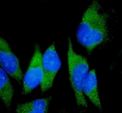 Immunofluorescent staining of FFPE human HeLa cells with Claudin 18 antibody (green) and DAPI nuclear stain (blue). HIER: steam section in pH6 citrate buffer for 20 min.