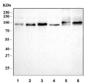Western blot testing of 1) human Jurkat, 2) human HepG2, 3) human PC-2, 4) human Raji, 5) rat testis and 6) mouse testis tissue lysate with Calmegin antibody. Predicted molecular weight ~70 kDa but can be observed at ~93 kDa with an ~101 kDa phosphorylated form.