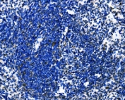 IHC staining of FFPE mouse spleen tissue with Dectin 1 antibody. HIER: boil tissue sections in pH8 EDTA for 20 min and allow to cool before testing.