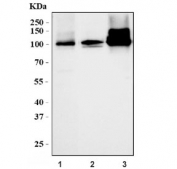 Western blot testing of 1) rat testis, 2) rat H9c2(2-1) cells and 3) mouse testis tissue lysate with Clgn antibody. Predicted molecular weight ~70 kDa but can be observed at ~93 kDa with an ~101 kDa phosphorylated form.