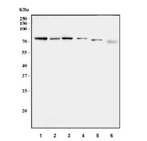 Western blot testing of 1) human MCF7, 2) human RT-4, 3) rat liver, 4) rat kidney, 5) mouse liver and 6) mouse kidney tissue lysate with CPT1-L antibody. Predicted molecular weight ~86 kDa.