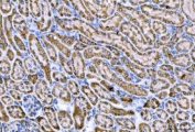 IHC staining of FFPE rat kidney tissue with CPT1-L antibody. HIER: boil tissue sections in pH8 EDTA for 20 min and allow to cool before testing.